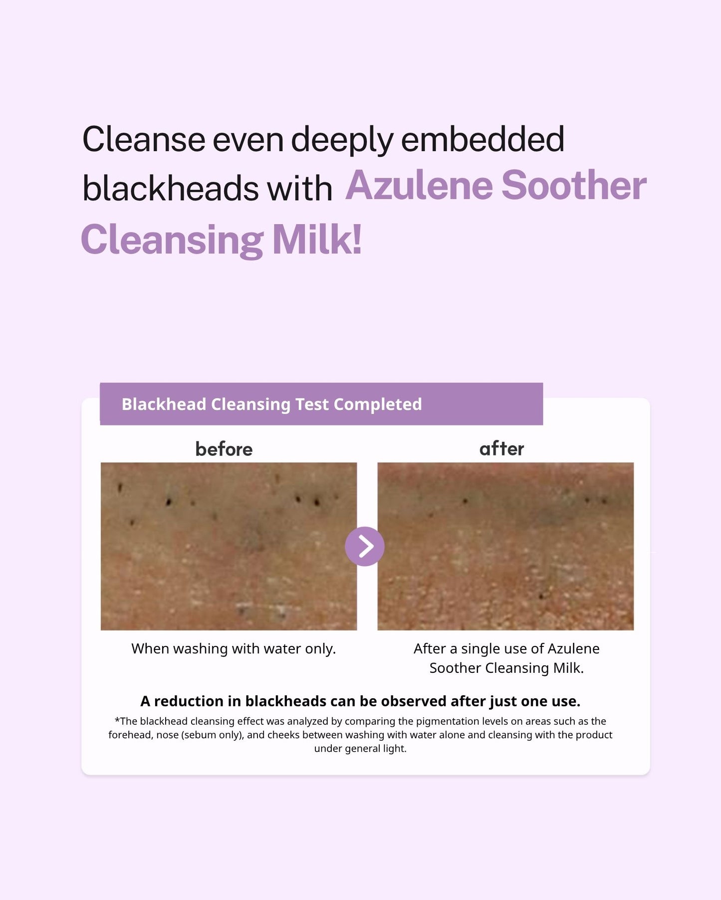 Dr. Sante Azulene Soother Cleansing Milk 200ml/500ml