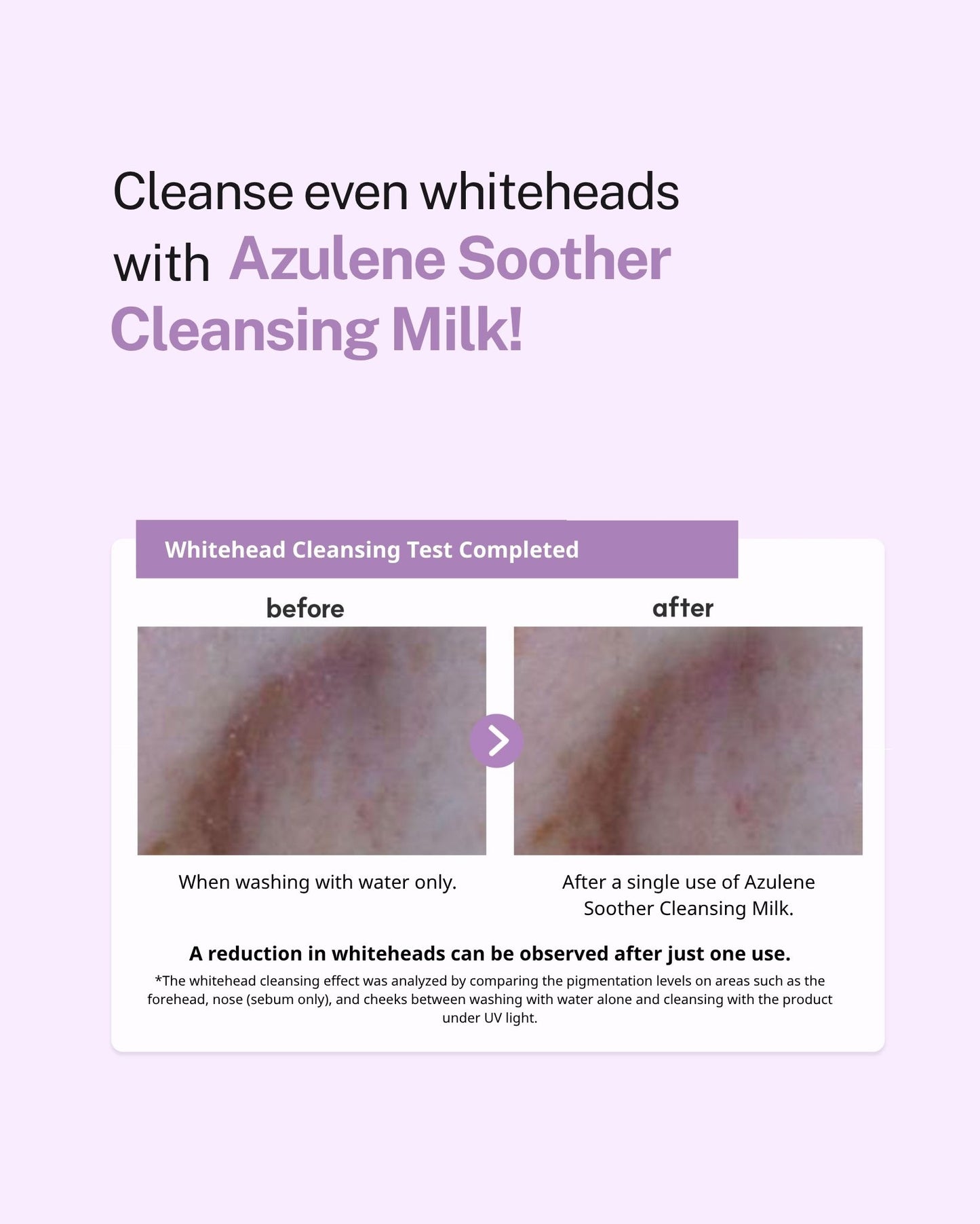 Dr. Sante Azulene Soother Cleansing Milk 200ml/500ml