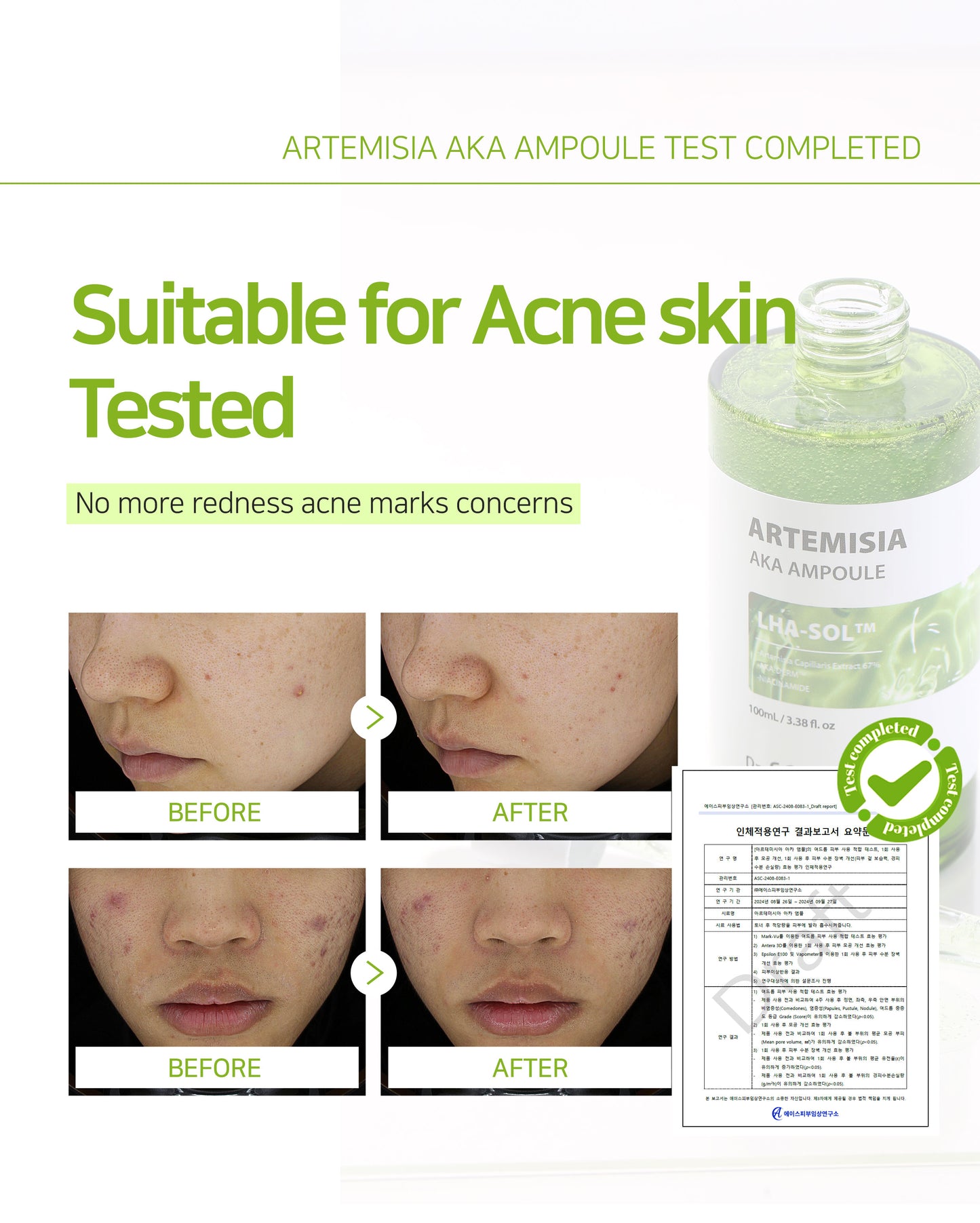 Dr.Sante Artemisia AKA Ampoule 50ml / 100ml