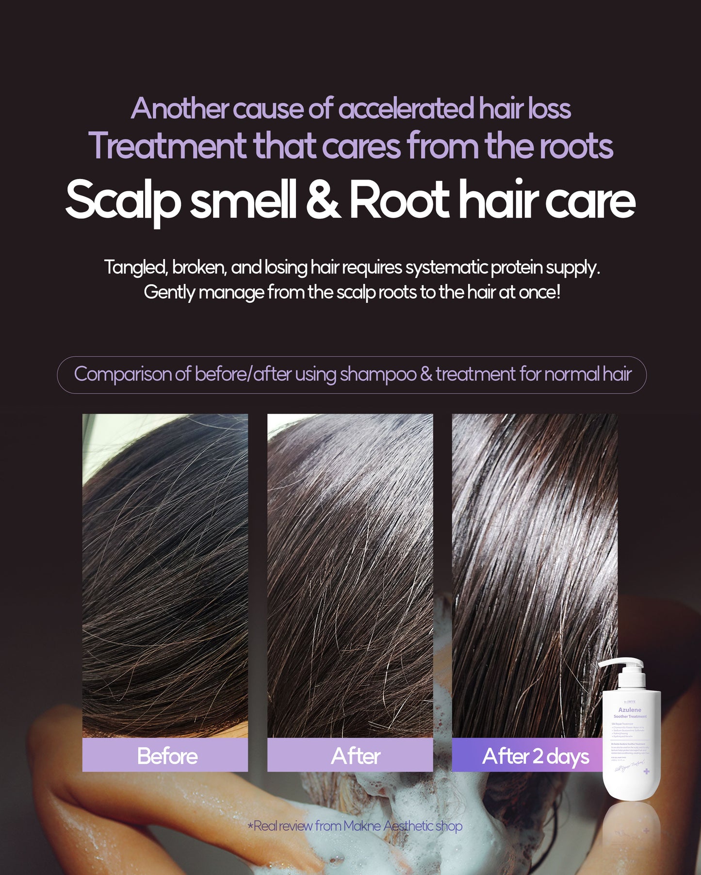 Dr. Sante Azulene Soother Treatment (Conditioner) 500ml