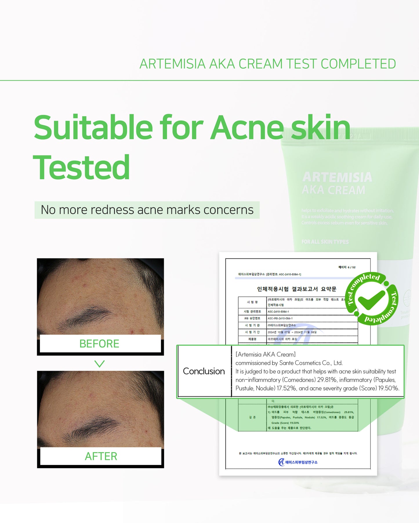 Dr. Sante Artemisia AKA Cream 50g / 150g