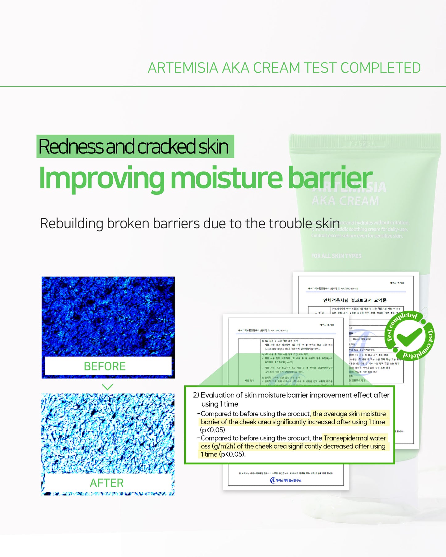 Dr. Sante Artemisia AKA Cream 50g / 150g