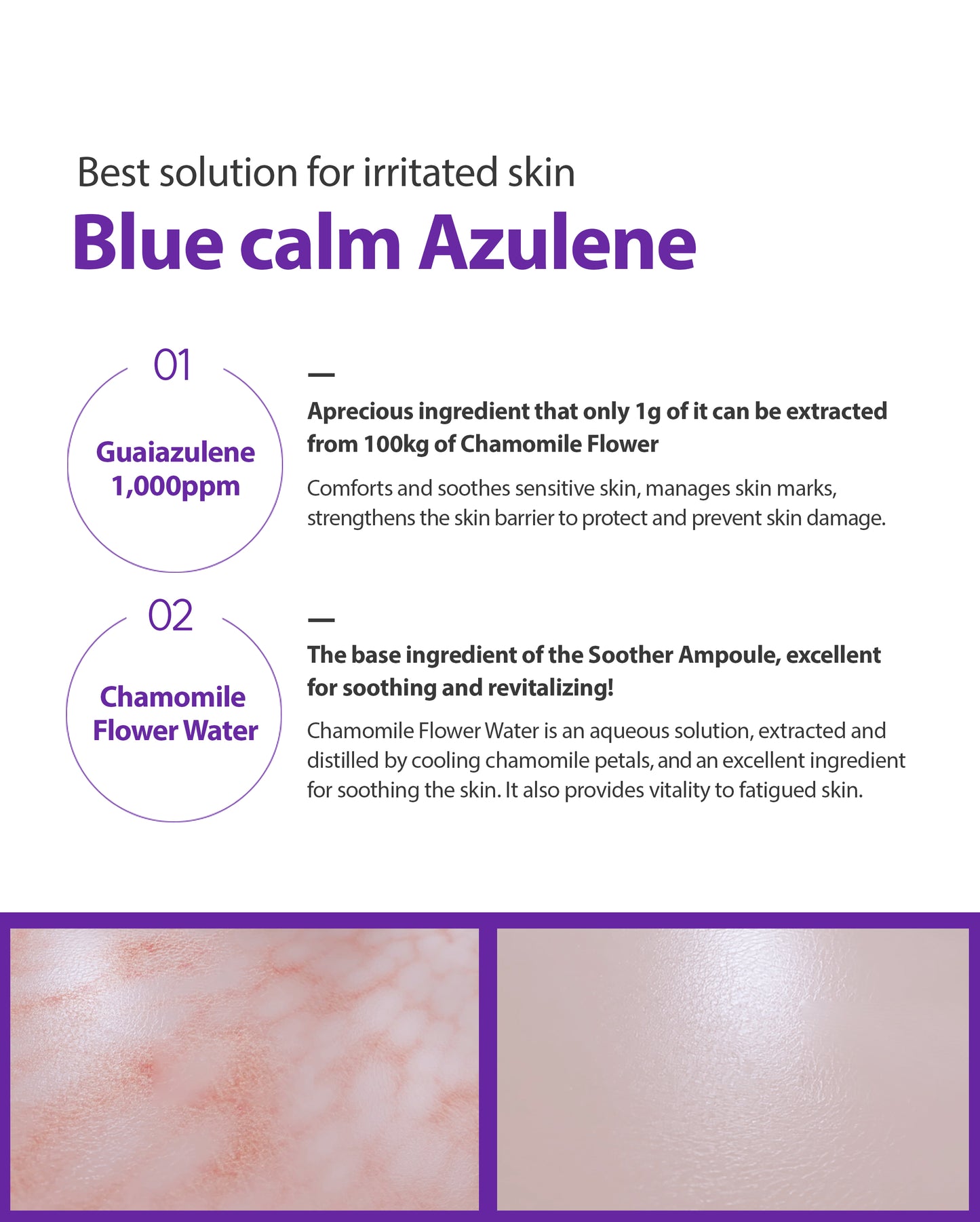 Dr.Sante Azulene Soother Ampoule 50ml / 100ml