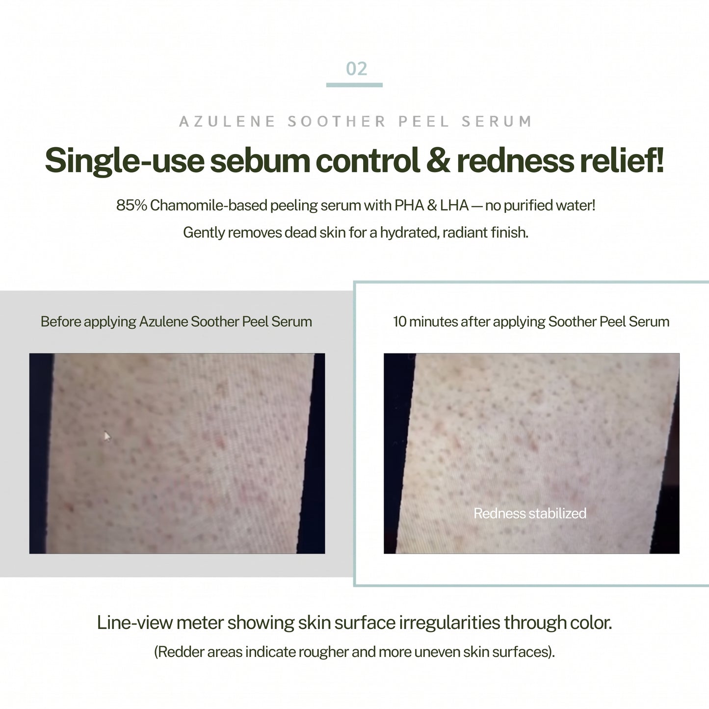 Dr. Sante Soother Peel Serum 50ml