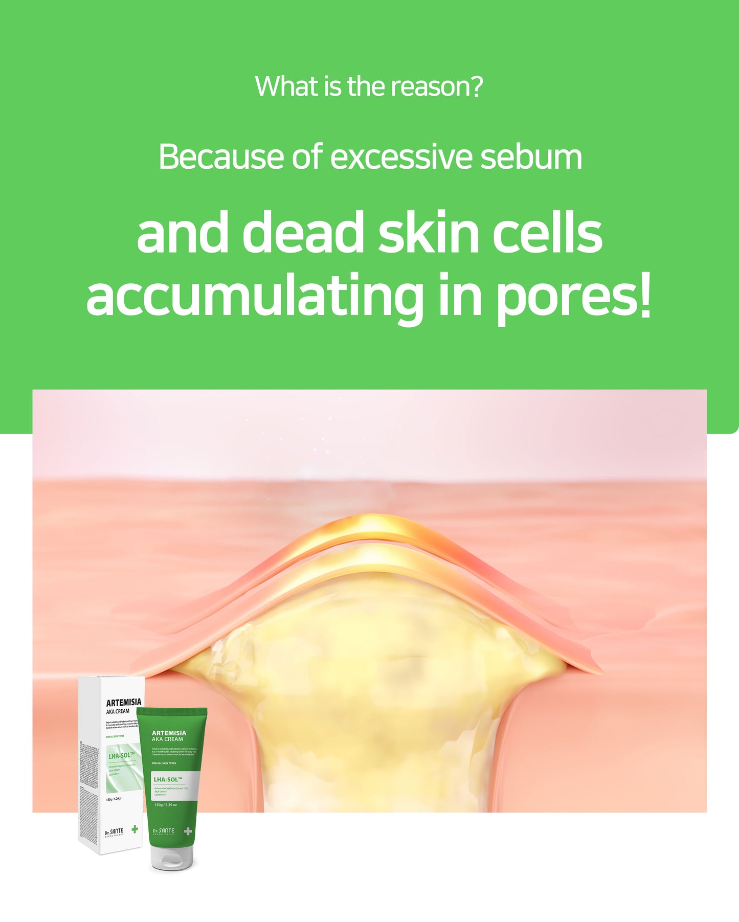 Dr. Sante Artemisia AKA Cream 50g / 150g (1.76oz to / 5.29 oz)

Calming Sebum Balance Cream for Sensitive &amp; Troubled Skin

A soothing daily cream formulated with 72% Artemisia Capillaris Extract to help calm irritated skin, reduce skin temperature, and maintain balanced skin condition.

Infused with LHA-SOL™ and the patented AKA-DERM™ complex, this lightweight cream helps regulate excess sebum while improving the appearance of pores and rough skin texture. Designed for sensitive and troubled skin, the f